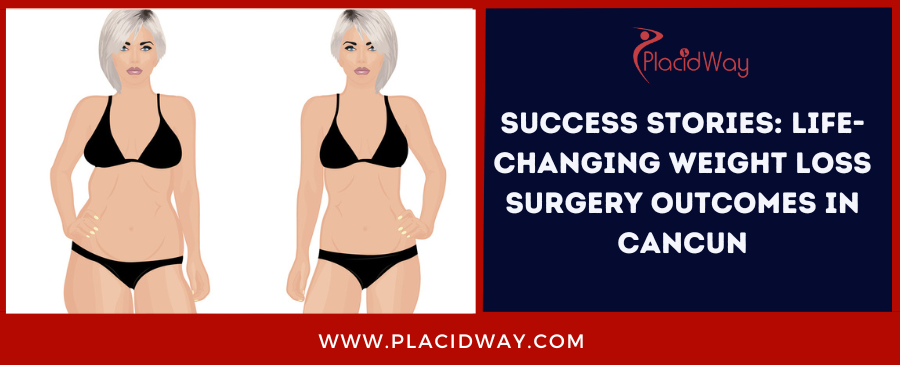 Success Stories: Life-Changing Weight Loss Surgery Outcomes in Cancun