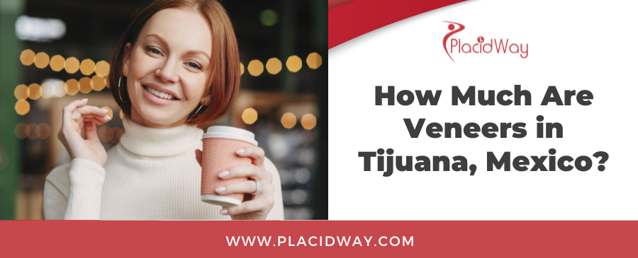 How Much Are Veneers in Tijuana, Mexico?