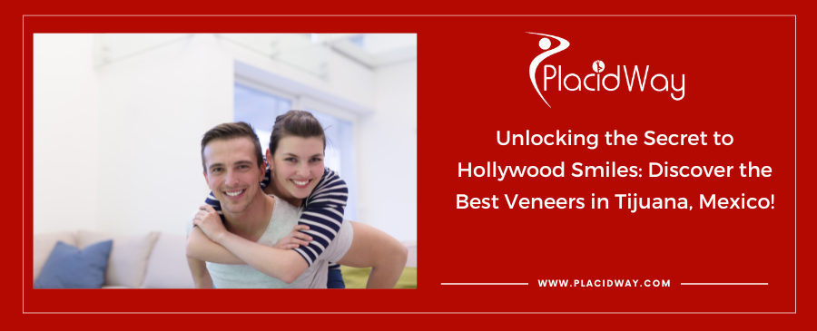 Unlocking the Secret to Hollywood Smiles: Discover the Best Veneers in Tijuana, Mexico!