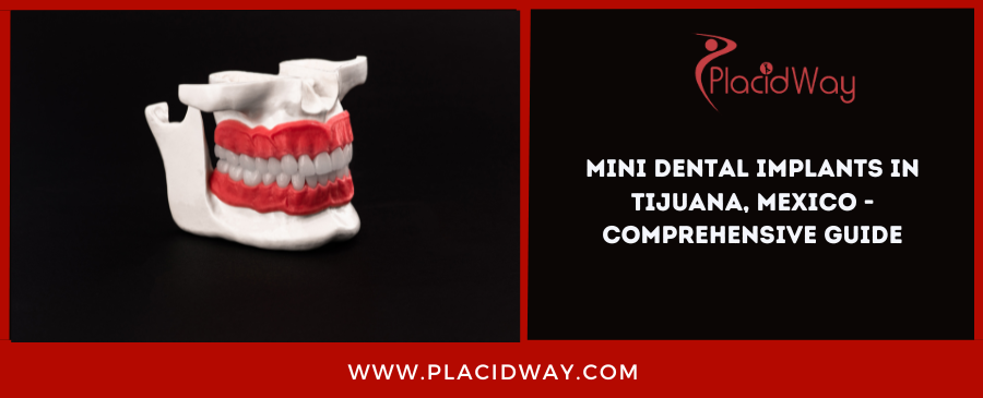 Mini Dental Implants in Tijuana, Mexico