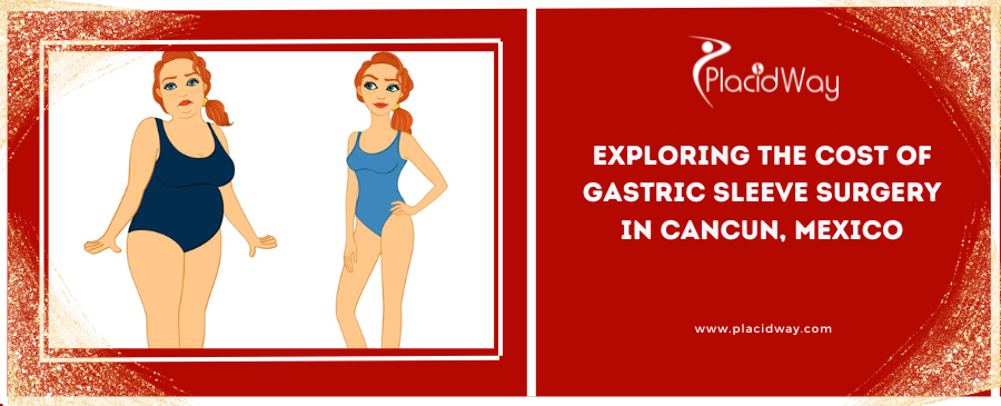 Exploring the Cost of Gastric Sleeve Surgery in Cancun, Mexico