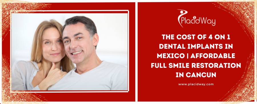 The Cost of 4 on 1 Dental Implants in Mexico | Affordable Full Smile Restoration in Cancun