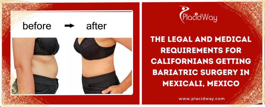 The Legal and Medical Requirements for Californians Getting Bariatric Surgery in Mexicali, Mexico 