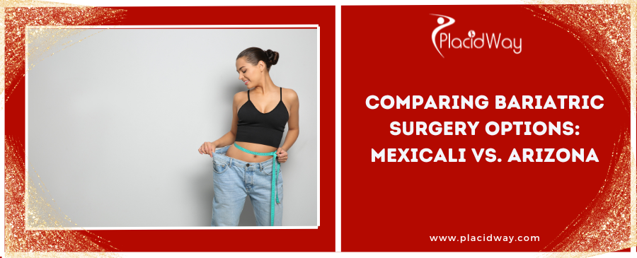 Comparing Bariatric Surgery Options: Mexicali vs. Arizona
