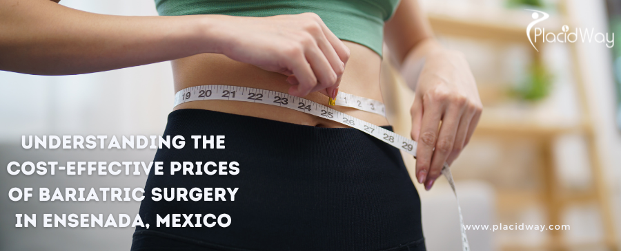 Understanding the Cost-Effective Prices of Bariatric Surgery in Ensenada, Mexico