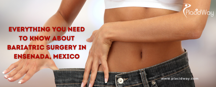 Everything You Need to Know About Bariatric Surgery in Ensenada, Mexico