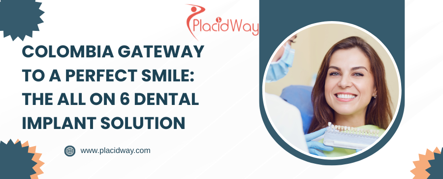 Colombia's Gateway to a Perfect Smile: The All on 6 Dental Implant Solution