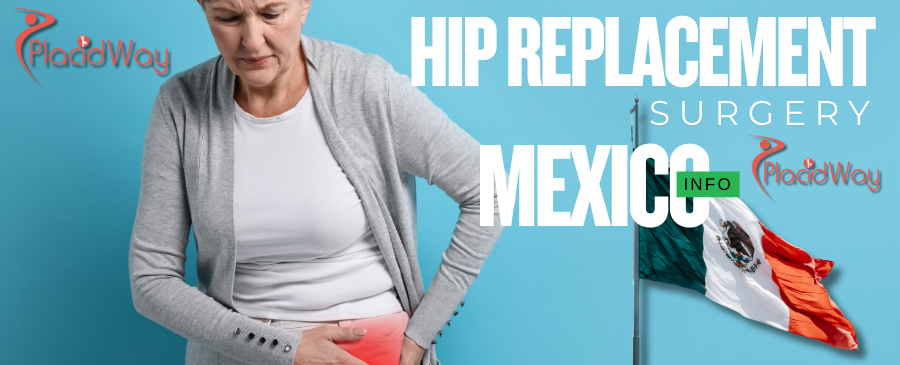 Hip Replacement Surgery in Mexicali, Mexico