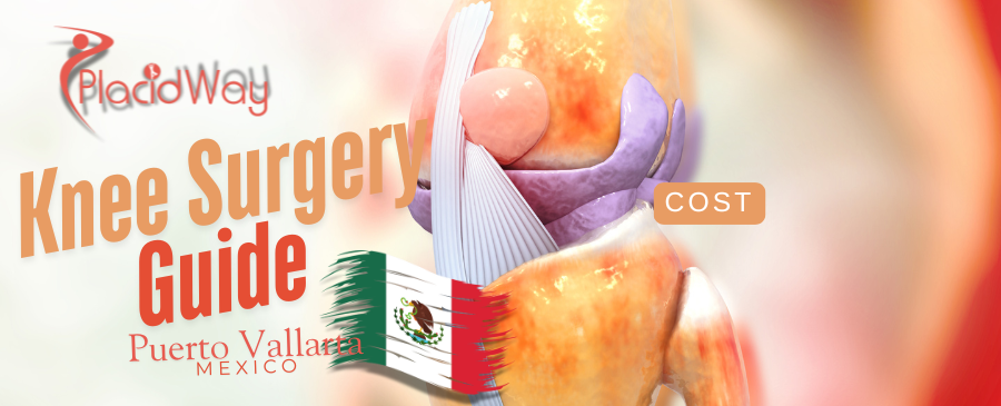  Knee Surgery in Puerto Vallarta, Mexico