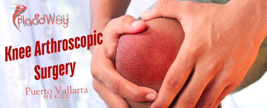 Knee Arthroscopic Surgery in Puerto Vallarta, Mexico