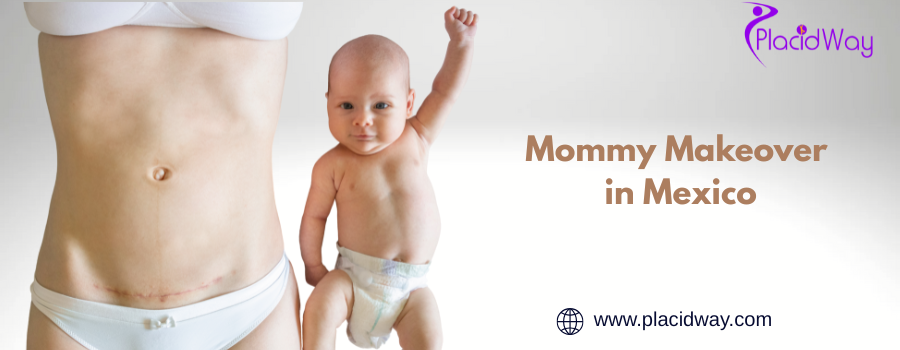 Mommy Makeover in  Mexico