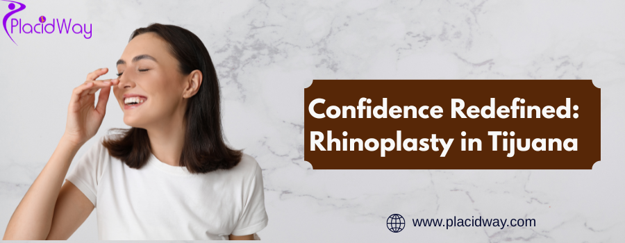  Rhinoplasty in Tijuana