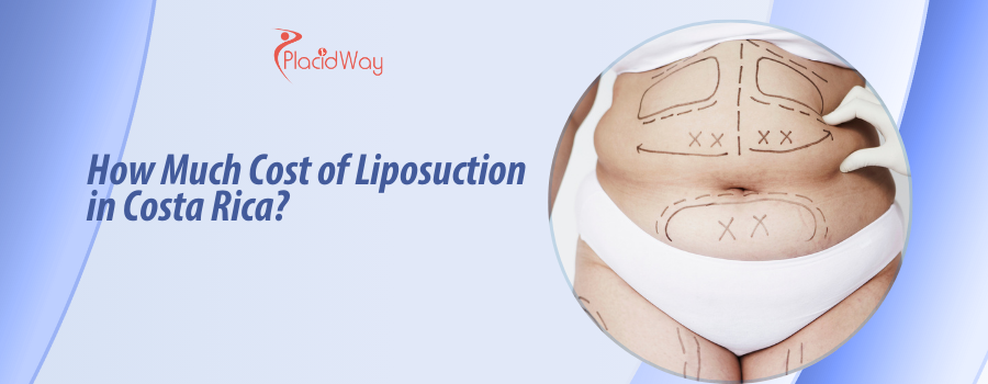 Cost of Liposuction in Costa Rica