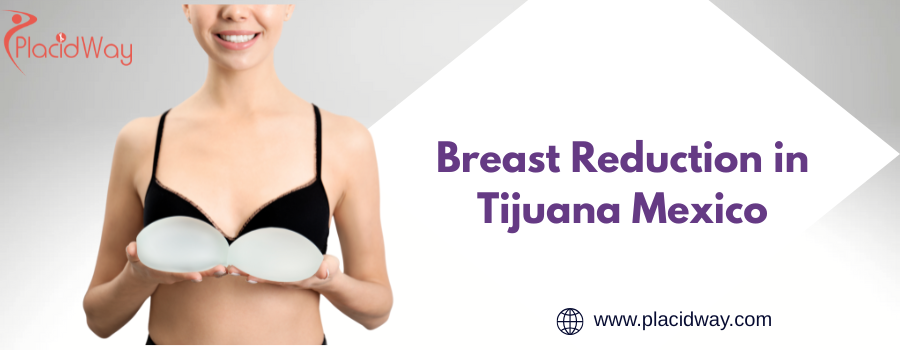 Breast Reduction in Tijuana Mexico