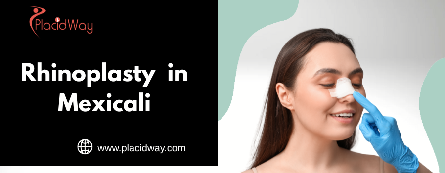 Rhinoplasty  in Mexicali