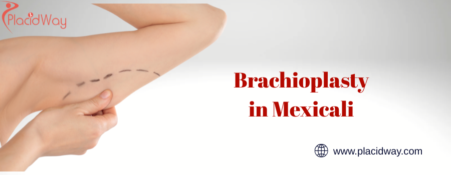 Brachioplasty in Mexicali