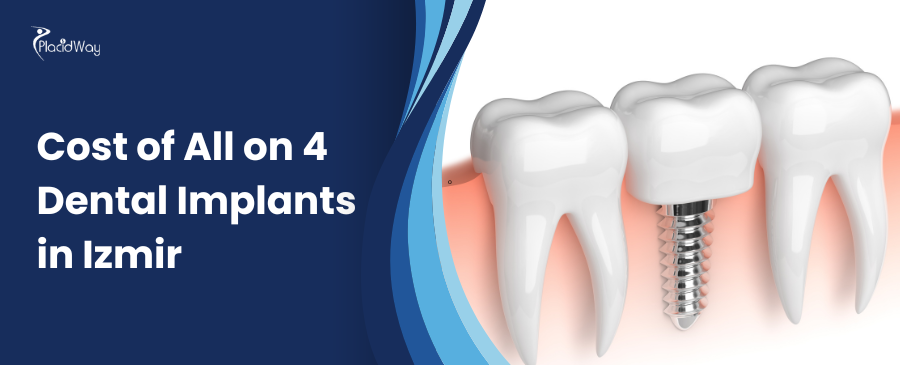 Cost of All on 4 Dental Implants in Izmir