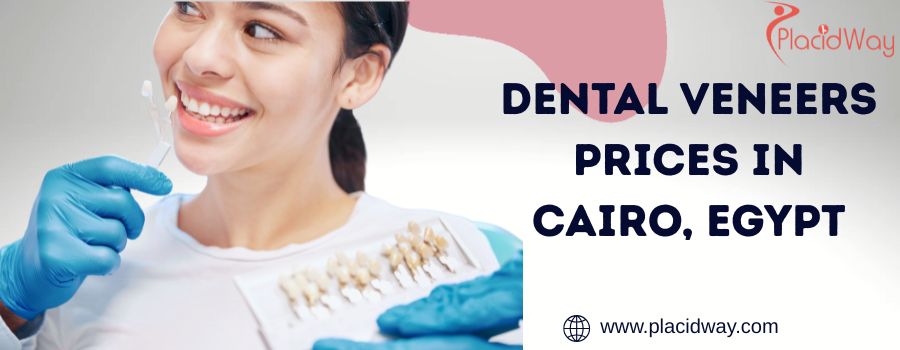 Dental Veneers Prices in Cairo, Egypt
