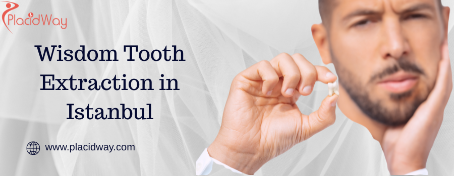 Wisdom Tooth Extraction in Istanbul