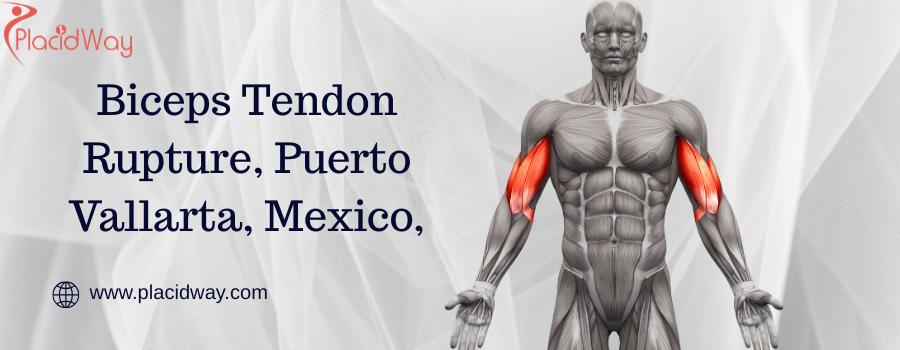 Biceps Tendon Rupture, Puerto Vallarta, Mexico,