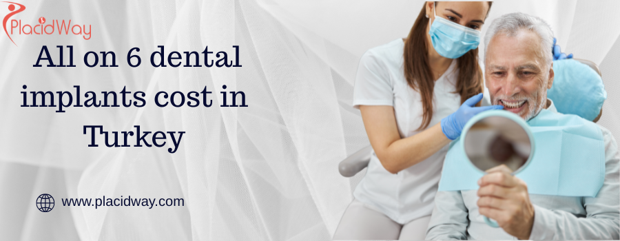  All on 6 dental implants cost in Turkey