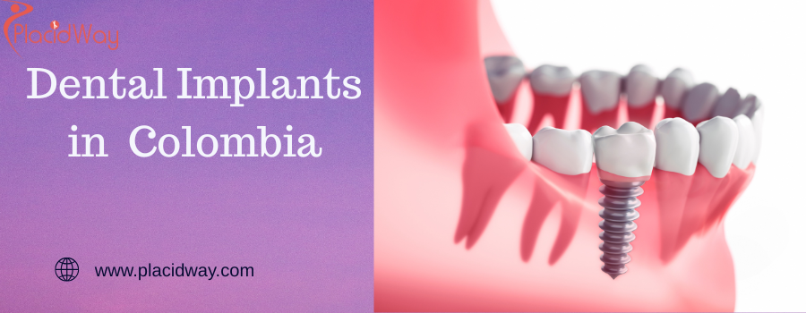 Dental Implants in  Colombia