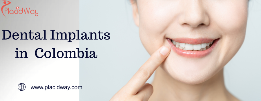Dental Implants in  Colombia