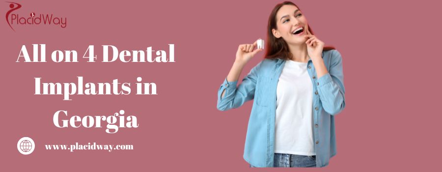 All on 4 Dental Implants in Georgia