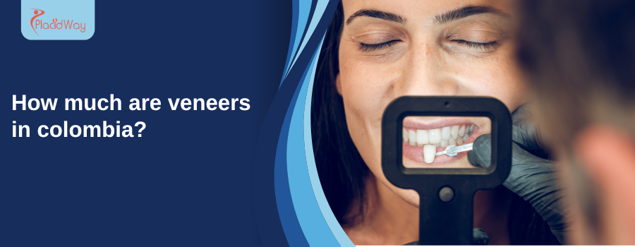 Dental veneers in Colombia