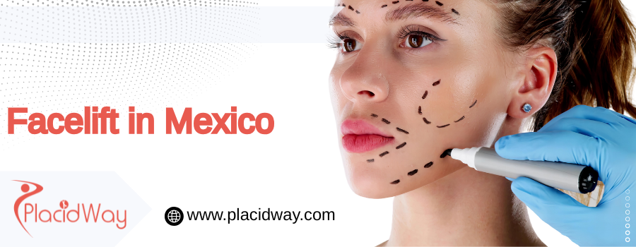 cost facelift in Mexico