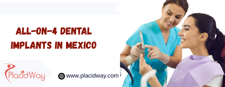 All-on-4 dental implants in Mexico