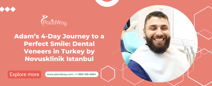 Dental Veneers in Turkey