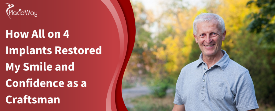How All on 4 Implants Restored My Smile and Confidence as a Craftsman