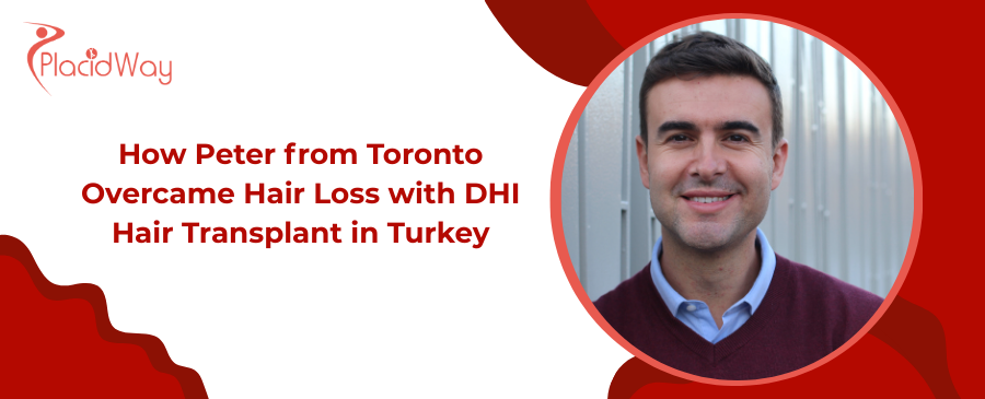 DHI Hair Transplant in Turkey