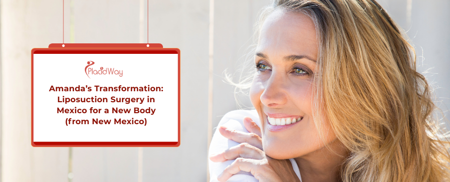Affordable Liposuction in Mexico