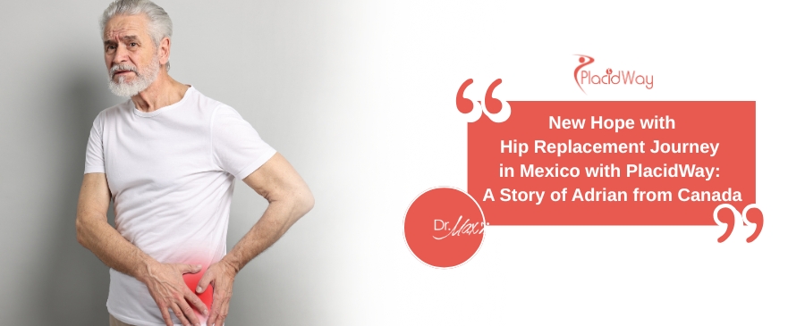 Hip Replacement Surgery in Mexico