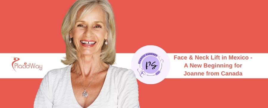 Face & Neck Lift in Mexico