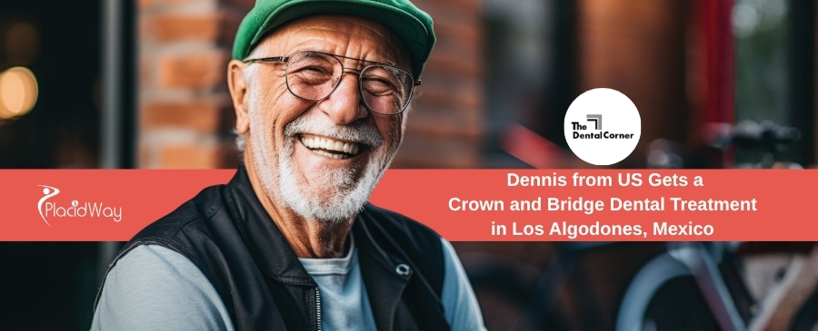 Crown and Bridge Dental Treatment in Los Algodones, Mexico