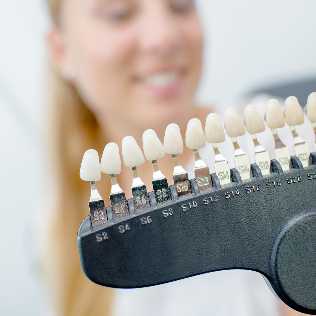 Veneers Cost in the Uk And Abroad PlacidWay