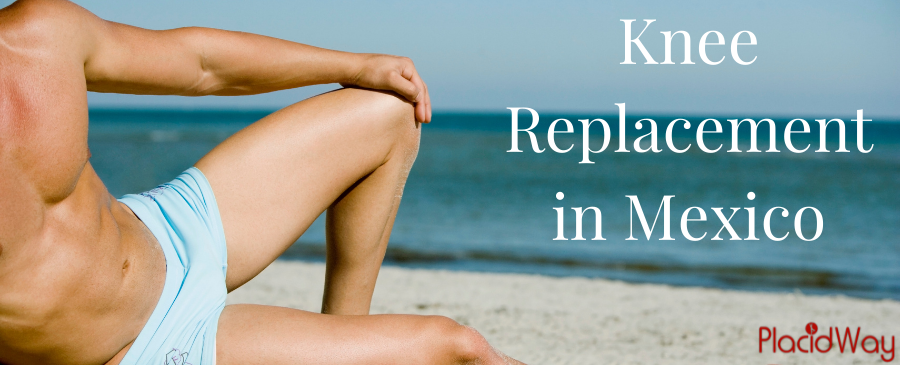 The Real Cost of Knee Replacement in Mexico: A Detailed Price Breakdown