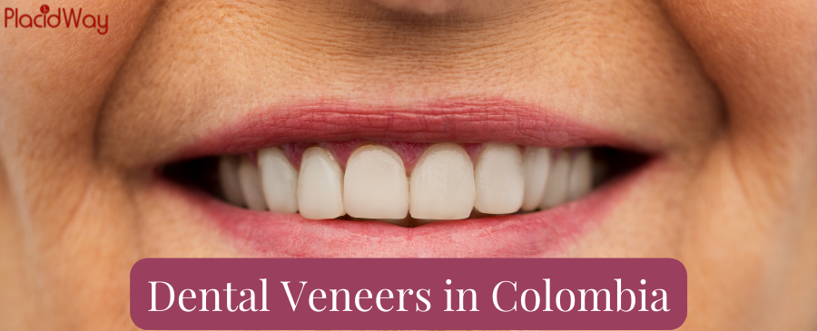Get Cheap and Safe Dental Veneers in Colombia