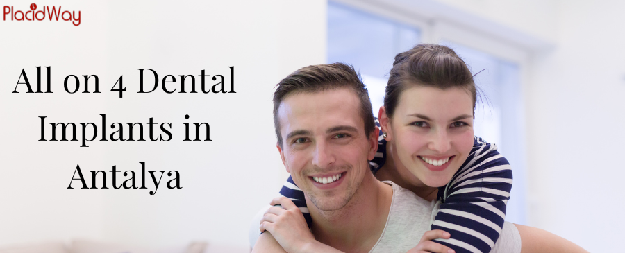 All-on-4 tandheelkundige implantaten in Antalya