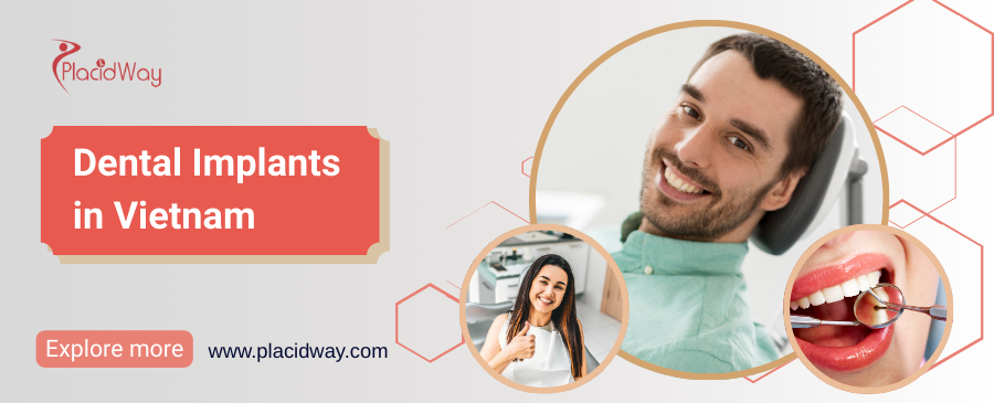 Dental Implants in Vietnam