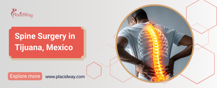 Spine Surgery in Tijuana, Mexico
