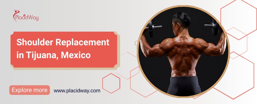 Shoulder Replacement in Tijuana, Mexico