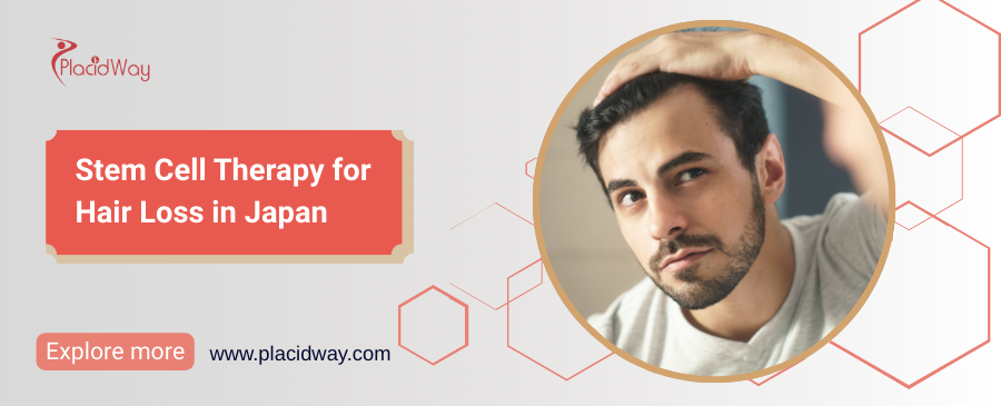 Stem Cell Therapy para sa Pagkalagas ng Buhok sa Japan
