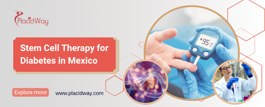 Diabetes Stem Cell Therapy in Mexico