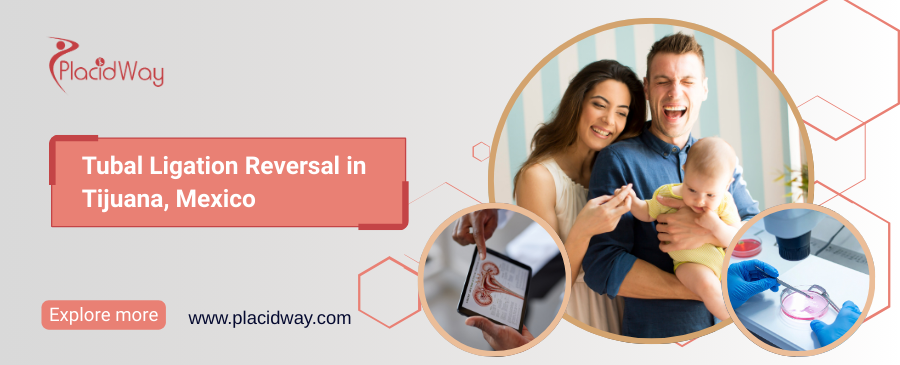 Tubal Ligation Reversal in Tijuana, Mexico