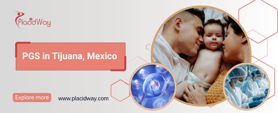 PGS in Tijuana, Mexico