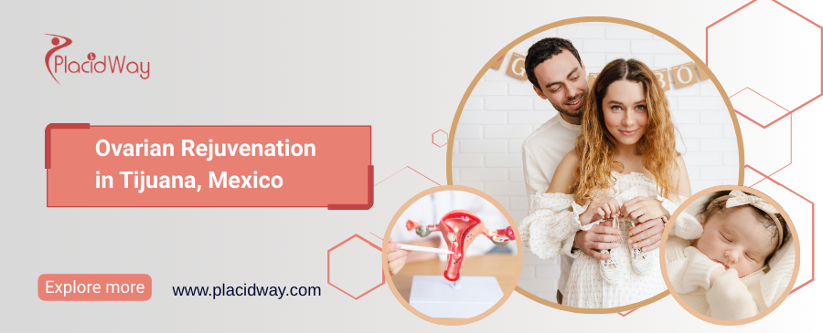 Ovarian Rejuvenation in Tijuana, Mexico